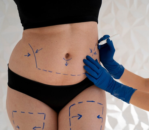 doctors procedure img2